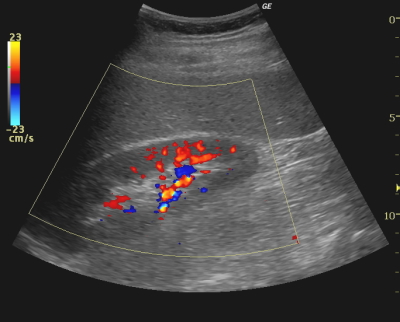 �J���[�h�v��