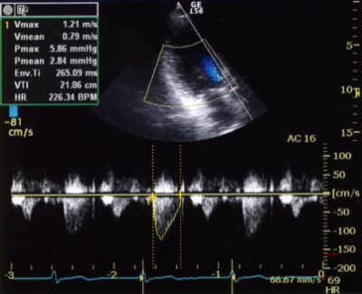 �A���g�h�v��