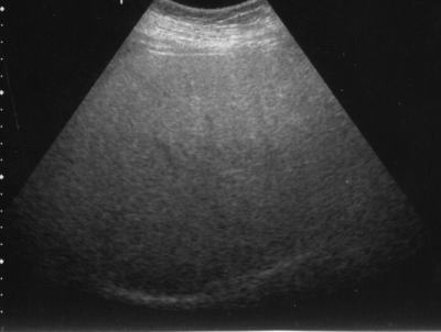 �����g�̌���