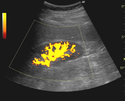 �p���[�h�v��